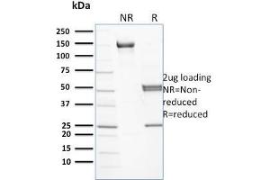 Spectrin beta Chain, Erythrocyte (SPTB) 抗体