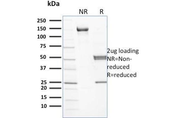 Spectrin beta Chain, Erythrocyte (SPTB) 抗体