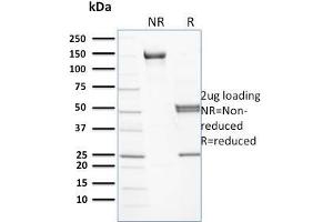 SDS-PAGE Analysis Purified Spectrin beta III Mouse Monoclonal Antibody (RG/26). (Spectrin beta Chain, Erythrocyte (SPTB) 抗体)