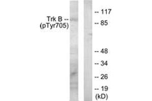 Western blot analysis of extracts from mouse kidney, using Trk B (Phospho-Tyr705) Antibody. (TRKB 抗体  (pTyr706))