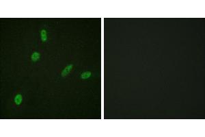 Peptide - +Immunofluorescence analysis of HeLa cells, using ETS1 (Ab-38) antibody. (ETS1 抗体  (Thr38))