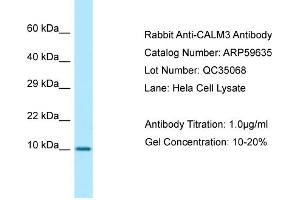 Western Blotting (WB) image for anti-Calmodulin 3 (Phosphorylase Kinase, Delta) (CALM3) (N-Term) antibody (ABIN2774263) (Calmodulin 3 抗体  (N-Term))