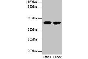 CKB 抗体  (AA 2-270)