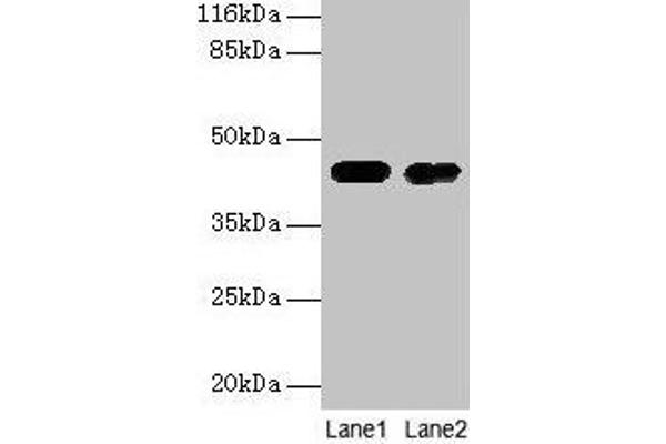 CKB 抗体  (AA 2-270)