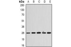 Western blot analysis of Calpain reg expression in Hela (A), SKOV3 (B), mouse heart (C), mouse spleen (D), rat lung (E) whole cell lysates. (Calpain Reg 抗体)