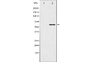 Western blot analysis of PAK1 expression in Etoposide treated 293 whole cell lysates,The lane on the left is treated with the antigen-specific peptide. (PAK1 抗体  (Internal Region))