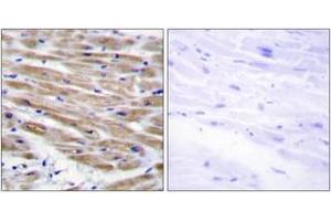 Immunohistochemistry (IHC) image for anti-Mitogen-Activated Protein Kinase Kinase Kinase 4 (MAP3K4) (AA 1281-1330) antibody (ABIN2889836) (MAP3K4 抗体  (AA 1281-1330))