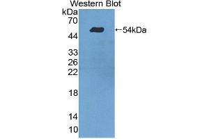 Western blot analysis of the recombinant protein. (TDP1 抗体  (AA 4-215))