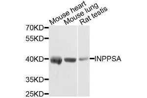 Western blot analysis of extracts of various cell lines, using INPP5A antibody. (INPP5A 抗体  (AA 10-200))
