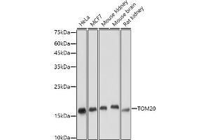 Western blot analysis of extracts of various cell lines, using TOM20 antibody (ABIN7268554) at 1:5000 dilution. (TOMM20 抗体  (AA 20-145))