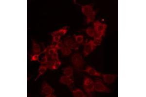 Immunofluorescence (fixed cells) (IF/ICC) image for anti-Tumor Necrosis Factor (Ligand) Superfamily, Member 10 (TNFSF10) (Internal Region) antibody (ABIN6259218)