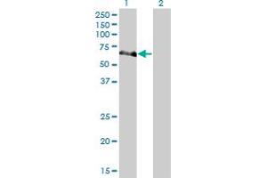 Western Blot analysis of NEK10 expression in transfected 293T cell line by NEK10 monoclonal antibody (M01), clone 1C9. (NEK10 抗体  (AA 211-300))