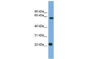WB Suggested Anti-C21orf45 Antibody Titration:  0.