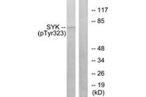 Western blot analysis of extracts from HT29 cells, using SYK (Phospho-Tyr323) Antibody. (SYK 抗体  (pTyr323))
