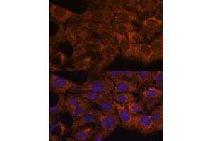 Immunofluorescence (IF) image for anti-Sec23 Homolog B (SEC23B) (AA 150-250) antibody (ABIN7270169)