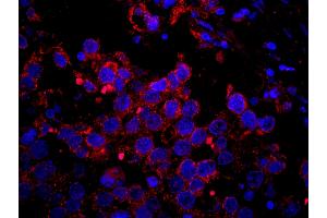 Immunofluorescence (IF) image for anti-Insulin Receptor Substrate 2 (IRS2) (AA 1288-1338) antibody (ABIN7448980) (IRS2 抗体  (AA 1288-1338))