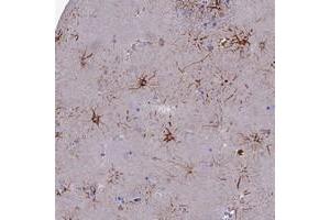 Immunohistochemical staining of human lateral ventricle with CYB561D2 polyclonal antibody  shows strong cytoplasmic positivity in fraction of glial cells. (CYB561D2 抗体)