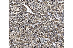 IHC analysis of Liver Carboxylesterase 1/CES1 using anti-Liver Carboxylesterase 1/CES1 antibody (ABIN7602719).