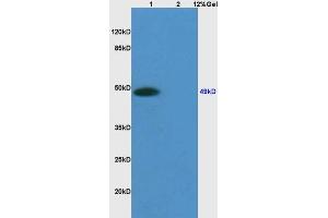 Lane 1: mouse embryo lysates Lane 2: mouse heart lysates probed with Anti Sphingomyelin Synthase 1 Polyclonal Antibody, Unconjugated (ABIN705371) at 1:200 in 4 °C. (Sphingomyelin Synthase 1 抗体  (AA 331-413))