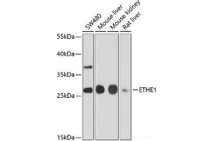 Western blot analysis of extracts of various cell lines using ETHE1 Polyclonal Antibody at dilution of 1:1000. (ETHE1 抗体)