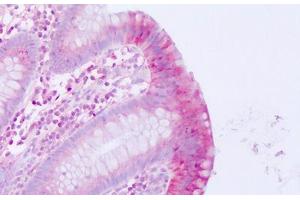 Anti-MLNR / Motilin Receptor antibody IHC staining of human colon, epithelium. (Motilin Receptor 抗体  (Internal Region))