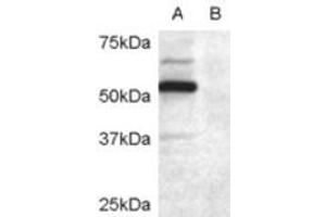 Western Blotting (WB) image for anti-Doublecortin Domain Containing 2 (DCDC2) (Internal Region) antibody (ABIN2465587) (DCDC2 抗体  (Internal Region))