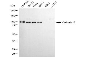 Western blotting analysis using Cadherin 13 antibody (ABIN7797821).
