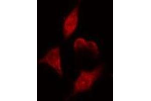 ABIN6275110 staining  HeLa cells by IF/ICC. (NEIL1 抗体  (Internal Region))