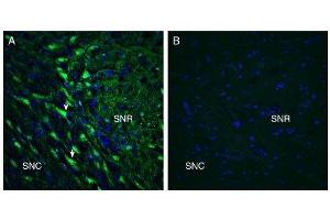 Expression of GPR55 in rat substantia nigra. (GPR55 抗体  (Extracellular))