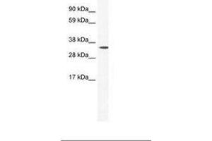 Image no. 1 for anti-Homeobox B1 (HOXB1) (AA 26-75) antibody (ABIN202186) (HOXB1 抗体  (AA 26-75))