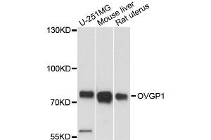 Western blot analysis of extracts of various cell lines, using OVGP1 antibody (ABIN6291552) at 1:3000 dilution. (OVGP1 抗体)
