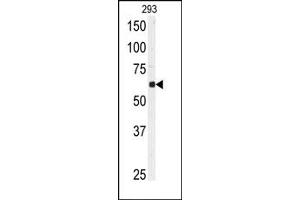 Image no. 1 for anti-Ubiquitin Specific Peptidase 3 (USP3) (N-Term) antibody (ABIN357523) (USP3 抗体  (N-Term))