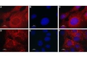 Expression of TRPML2 in mouse muscle myoblast (C2C12) cell line - Immunocytochemical staining of TRPML2 in C2C12 cells. (Mucolipin 2 (MCOLN2) (AA 212-228), (Intracellular), (N-Term) 抗体)