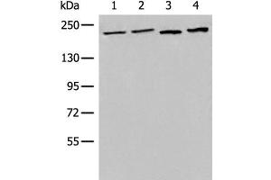 Western blot analysis of 293T cell Human metastatic malignant melanoma tissue lysates using EEA1 Polyclonal Antibody at dilution of 1:700 (EEA1 抗体)