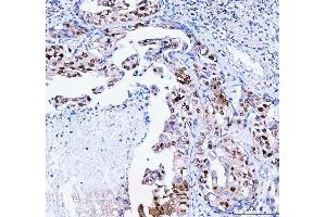 IHC analysis of FEN1 using anti-FEN1 antibody (ABIN7601617). (FEN1 抗体  (AA 4-300))