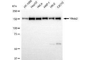 anti-YTH Domain Containing 2 (YTHDC2) antibody
