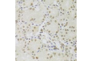 Immunohistochemistry of paraffin-embedded human stomach using PRPF3 Antibody (ABIN5973192) at dilution of 1/100 (40x lens). (PRPF3 抗体)