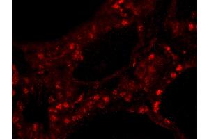 Immunofluorescence (IF) image for anti-Zinc Finger Protein 318 (Znf318) (AA 2049-2099) antibody (ABIN7449041) (ZNF318 抗体  (AA 2049-2099))