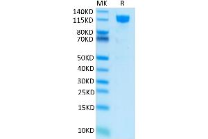 Human M-CSF R on Tris-Bis PAGE under reduced condition. (CSF1R Protein (AA 20-512) (Fc Tag))