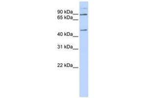 Image no. 1 for anti-Leber Congenital Amaurosis 5-Like (LCA5L) (C-Term) antibody (ABIN6740943) (LCA5L 抗体  (C-Term))