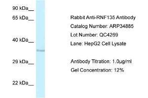 WB Suggested Anti-RNF135 Antibody   Titration: 1. (RNF135 抗体  (Middle Region))