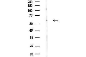 Western blot analysis of lysates from EC304 cells(heat-shock treatment), using FSCN1 Antibody at 1/1000 dilution.