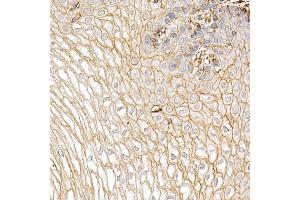 Immunohistochemistry of paraffin-embedded Human esophagus using S100 antibody (ABIN7270123) at dilution of 1:25 (40x lens). (S100A10 抗体  (AA 1-97))