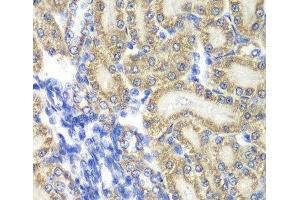 Immunohistochemistry of paraffin-embedded Rat kidney using PTGES2 Polyclonal Antibody at dilution of 1:100 (40x lens). (PTGES2 抗体)