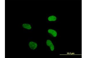 Immunofluorescence of purified MaxPab antibody to ATF6 on HeLa cell. (ATF6 抗体  (AA 1-202))