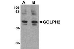 Western blot analysis of GOLPH2 in rat brain tissue lysate with AP30371PU-N GOLPH2 antibody at (A) 0. (GOLM1 抗体  (Center))