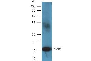 Rat placenta lysates probed with Rabbit Anti-PLGF Polyclonal Antibody, Unconjugated (ABIN727220) at 1:300 overnight at 4 °C. (PLGF 抗体  (AA 101-158))
