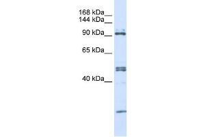 AARS antibody used at 1 ug/ml to detect target protein. (AARS 抗体  (N-Term))