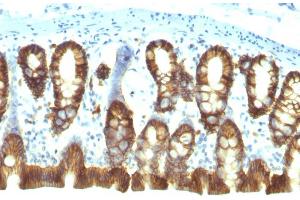 Formalin-fixed, paraffin-embedded Rat Colon stained with EpCAM Mouse Monoclonal Antibody (EGP40/1110).