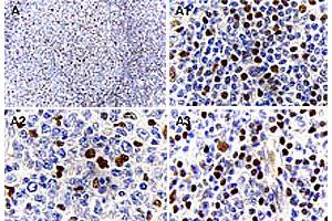 Immunohistochemical analysis of MALT1 expression in formalin-fixed human reactive lymph node.